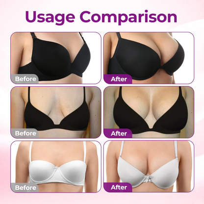 𝐏𝐮𝐫𝐞𝐥𝐨𝐫𝐚® Targeted Breast Enhancement Advanced Nano Microneedle Patch